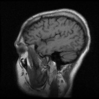 @my_actual_brain@fosstodon.org's avatar