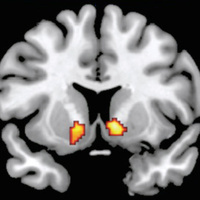 knutson_brain@sfba.social